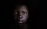 A child suffering from measles, who was carried from the bush by his father, is seen at the Goal clinic at Adong in South Sudan. Thousands of people in Africa's newest nation have been forced into internally displaced people camps by fierce inter-tribal fighting. 1. A child suffering from measles, who was carried from the bush by his father, is seen at the Goal clinic at Adong in South Sudan. Thousands of people in Africa's newest nation have been forced into internally displaced people camps by fierce inter-tribal fighting.